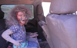 raqqa girl wounded